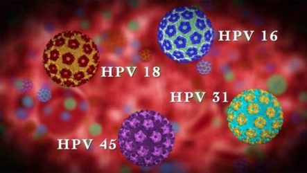 What to do when HPV type 18 is detected in women, how to treat the virus?