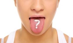 Condylomas in the mouth on the tongue: causes, symptoms, diagnosis and treatment