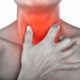 Papilloma on the tonsil: symptoms, diagnosis, treatment, prevention