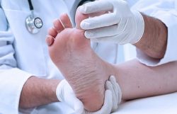 The main causes and treatment methods for warts on the feet