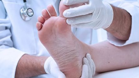 The main causes and treatment methods for warts on the feet