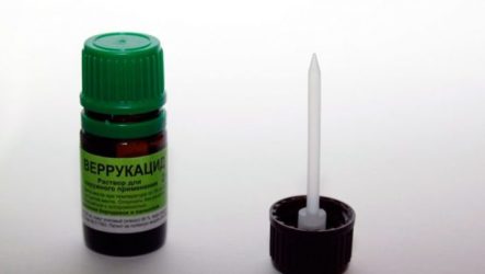 Application of Verrukatsid to remove warts and papillomas