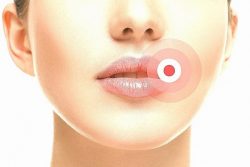 Causes and treatment methods for warts on the lip