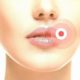 Causes and treatment methods for warts on the lip