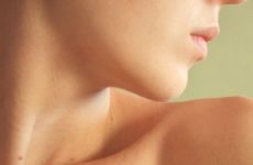 Why small warts on the neck and how to treat them