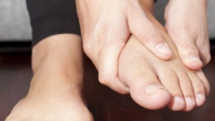 How to get rid of a wart on the foot at home?