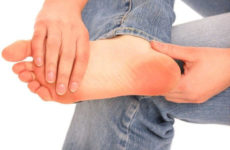 Advantages and disadvantages of laser removal of plantar warts