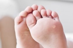 How to remove thorns on a child’s foot: an overview of treatment methods